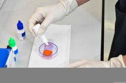 多囊卵巢可以做试管吗？多囊卵巢如何调理？
